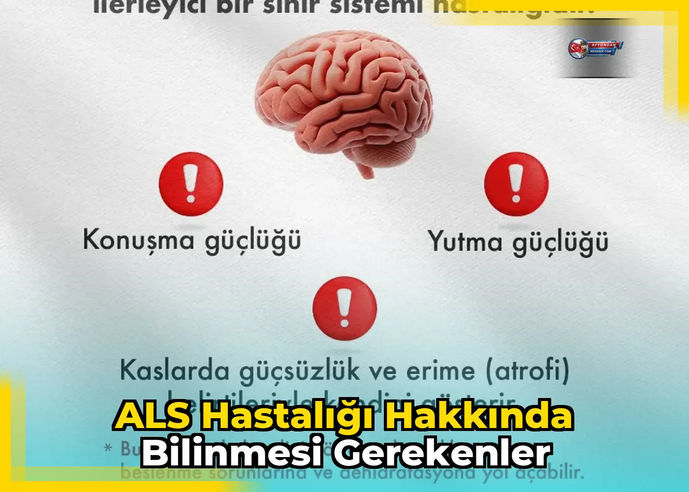 ALS hastalığı hakkında bilinmesi gerekenler