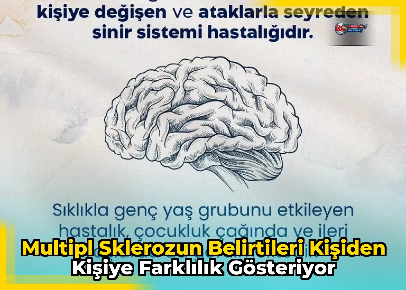 Multipl sklerozun belirtileri kişiden kişiye farklılık gösteriyor