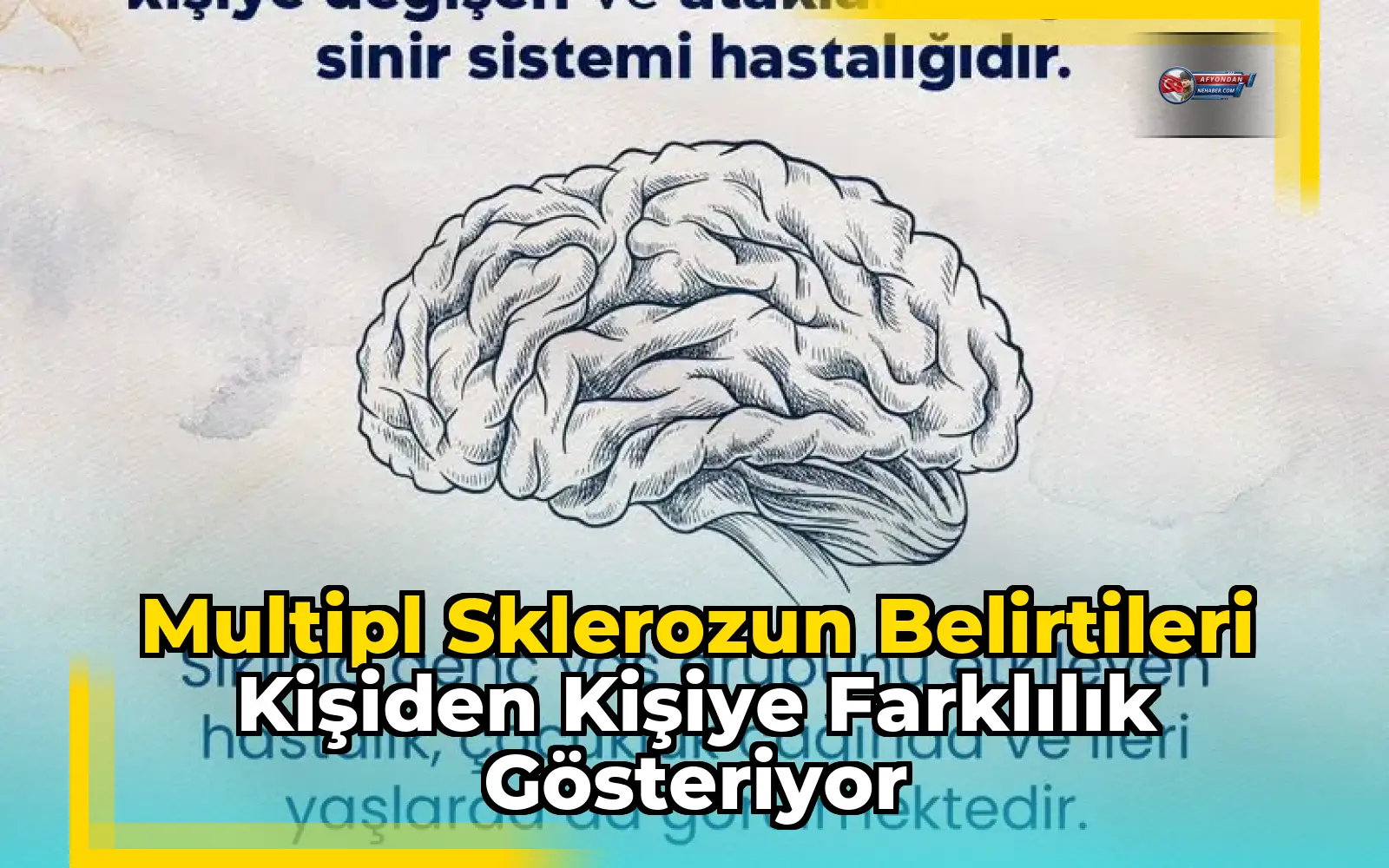 Multipl sklerozun belirtileri kişiden kişiye farklılık gösteriyor